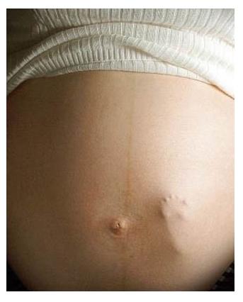 healthy_pregnancy_image